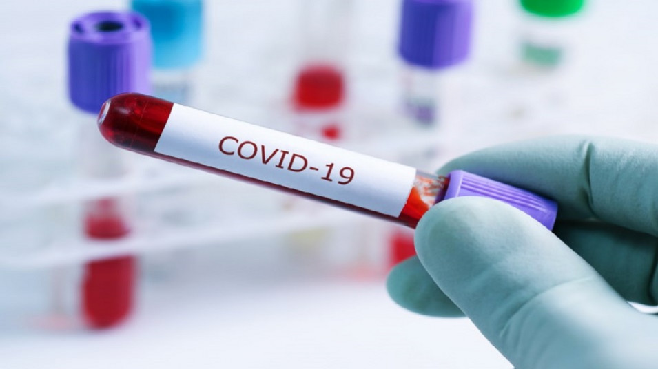تشخیص کووید-19